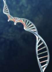 Gene linked to risk of common type of stroke
