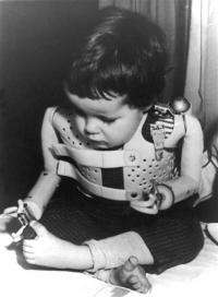 German drug firm makes 1st apology for thalidomide