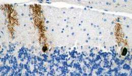 Glycogen accumulation in neurons causes brain damage and shortens the lives of flies and mice