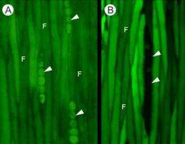 Long-distance solute transport in trees improved by intercellular pathways in living woody tissues
