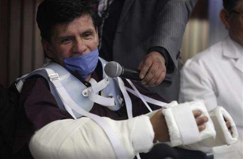 Mexican man gets double arm transplant