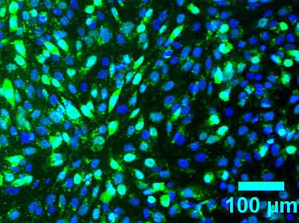 Molecular beacons light up stem cell transformation