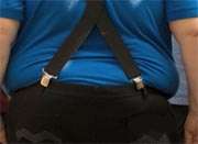 Obesity linked to economic status in developing countries