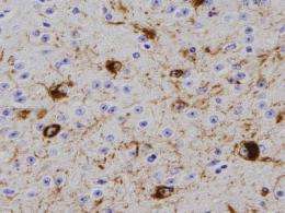 Parkinson's protein causes disease spread in animal model