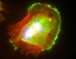 Researchers discover what cancer cells need to travel