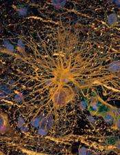 Scientists create 'endless supply' of myelin-forming cells