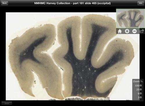 Einstein's brain is now interactive iPad app