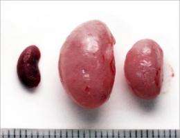 New drug shows promise for kidney disease