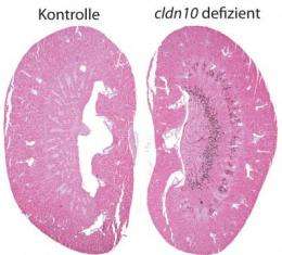 New insights into salt transport in the kidney