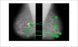 Visual nudge improves accuracy of mammogram readings