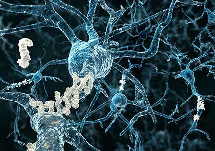 Understanding Alzheimer's: Study gives insights into how disease kills brain cells