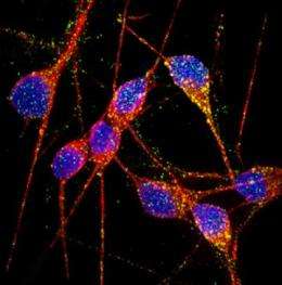 Researchers induce Alzheimer's neurons from pluripotent stem cells