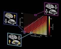 Study explores how brain disruption may foster schizophrenia