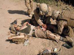 AP IMPACT: Surprising methods heal wounded troops