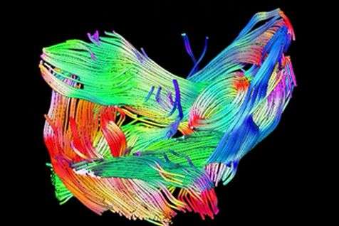 New MRI technique allows detailed imaging of complex muscle structures and muscle damage