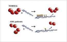 Researchers discover the processes leading to acute myeloid leukemia