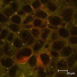 Researchers show influence of nanoparticles on nutrient absorption