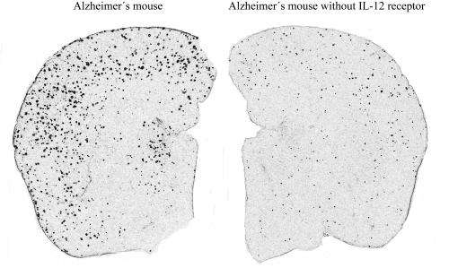Alzheimer's disease in mice alleviated promising therapeutic approach for humans