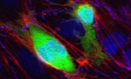 Targeting protein could prevent spread of cancer cells