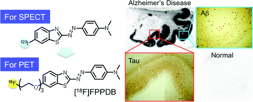 Advance toward an imaging agent for diagnosing Alzheimer's disease