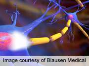 AES: brain's stress response differs among epilepsy patients