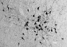 A new type of nerve cell found in the brain