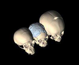 Anthropologist finds explanation for hominin brain evolution in famous fossil