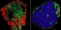 Antibodies reverse type 1 diabetes in new immunotherapy study