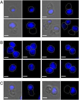 New insights into ancient life: Chromosome segregation in Archaea