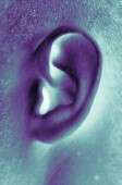 Basal cell carcinoma on ear significantly more aggressive
