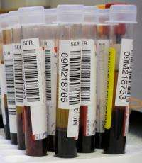Blood test predicts death from heart problems after surgery