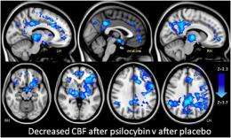 Your brain on 'shrooms': fMRI elucidates neural correlates of psilocybin psychedelic state