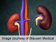 Conditioning regimen beneficial for kidney recipients
