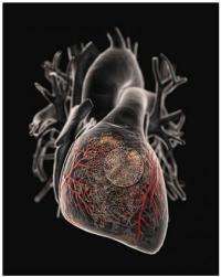 Delivery of gene-therapy for heart disease boosted 100-fold; now in 100-patient trial