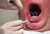 Dentists play key role in detecting oral cancer