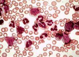 Enzyme accelerates malignant stem cell cloning in chronic myeloid leukemia
