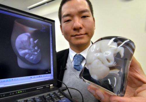 Expectant parents in Japan can now obtain a 3D model of the foetus