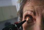 FDA警告一些激光眼科手术的误导性广告