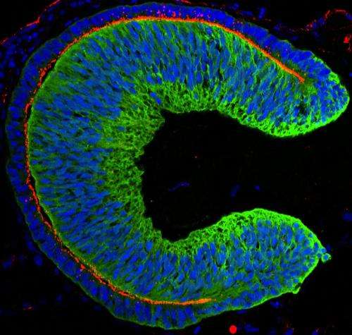 First mouse, now human, lab-grown eye tissue
