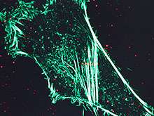 Fluorescence SIM available at EMSL: A powerful instrument to study molecular cell biology, including synthetic biology