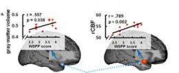Friendly to a fault, yet tense: Personality traits traced in brain