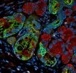 基因与胰腺癌的生长相关，研究发现