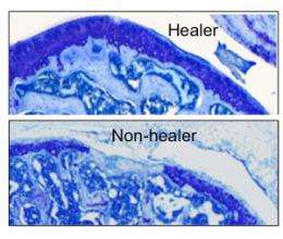 Genes that promote cartilage healing protect against arthritis