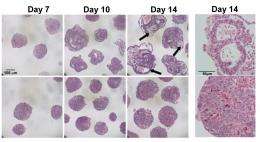 Genetic packing: Successful stem cell differentiation requires DNA compaction, study finds