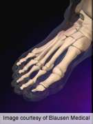 Gout is primary indication in about 0.2 percent of ER visits