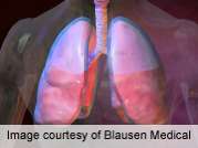 Human airways' 'Brush' mechanism gives clues to lung diseases