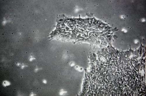 Human embryonic stem cells, now superseded in some research by induced pluripotent stem cells