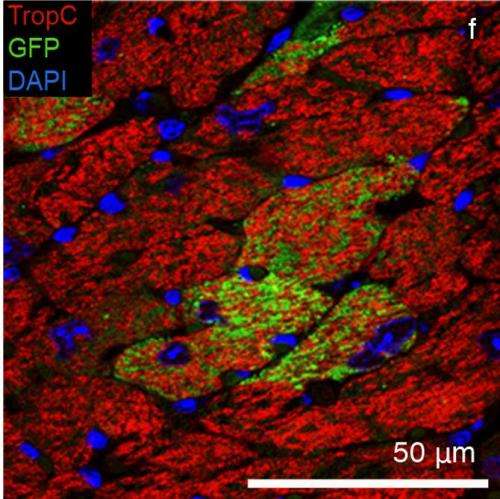 A novel therapeutic advancement in the search for heart muscle progenitor cells
