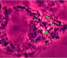 Internal cellular sensors make Salmonella dangerous, Yale researchers find