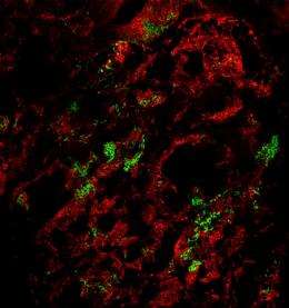 Lungs infected with plague bacteria also become playgrounds for other microbes
